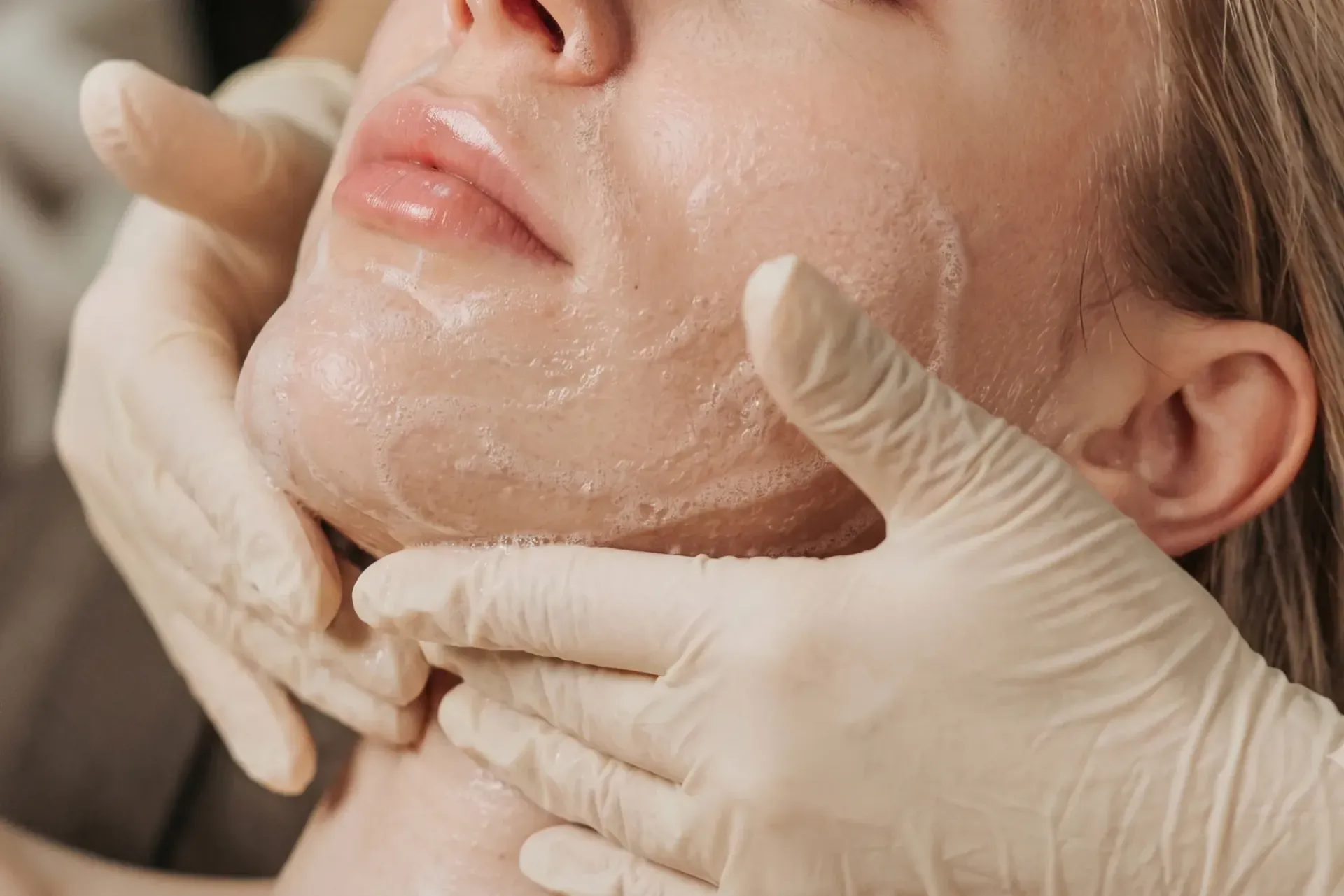 A close crop of an esthetician's gloved hands cradling a client's face during an exfoliating facial, her skin cleansed and glistening